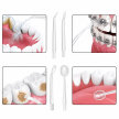 Irygator do Zębów Bezprzewodowy Dentystyczny Mocny 4 Dysze 3 Tryby 230 ml (8)