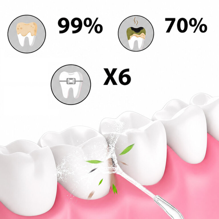Irygator do Zębów Bezprzewodowy Dentystyczny Mocny 4 Dysze 3 Tryby 230 ml (5)