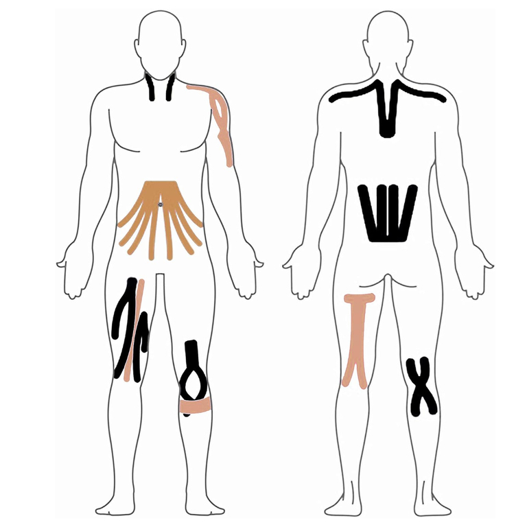 PLASTRY TAPE TEJPY KINESIOTAPING TEJP TAŚMA KINESIO SPORT PRO 5MX5CM  (16)