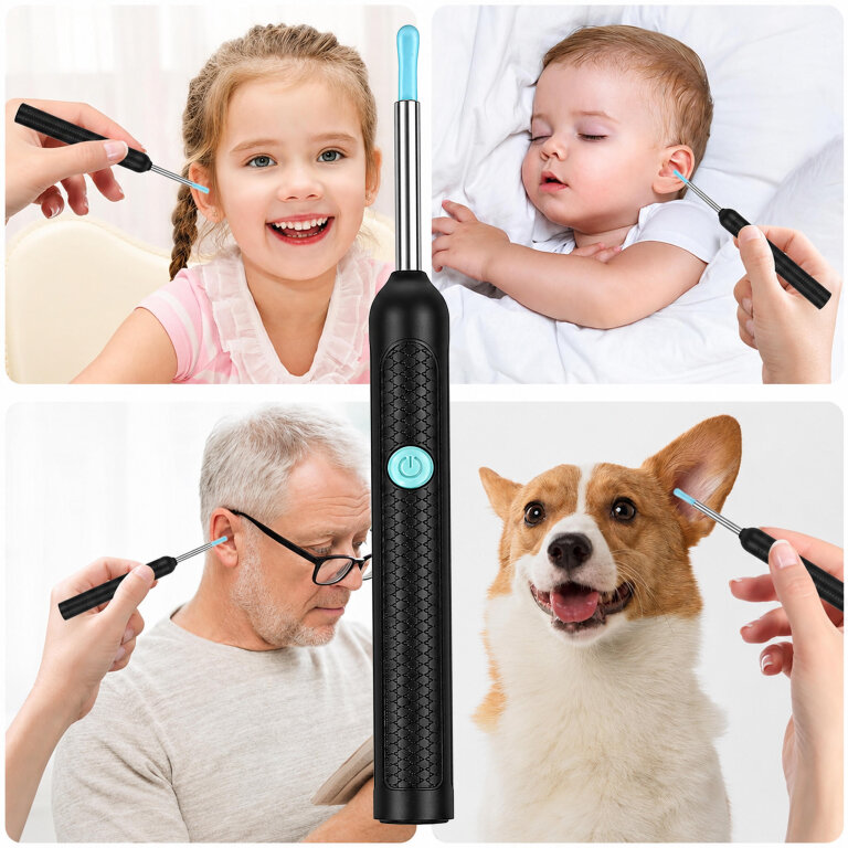 Otoskop Kamera do Czyszczenia Uszu Usuwania Woskowiny Smart HD Endoskop  (6)
